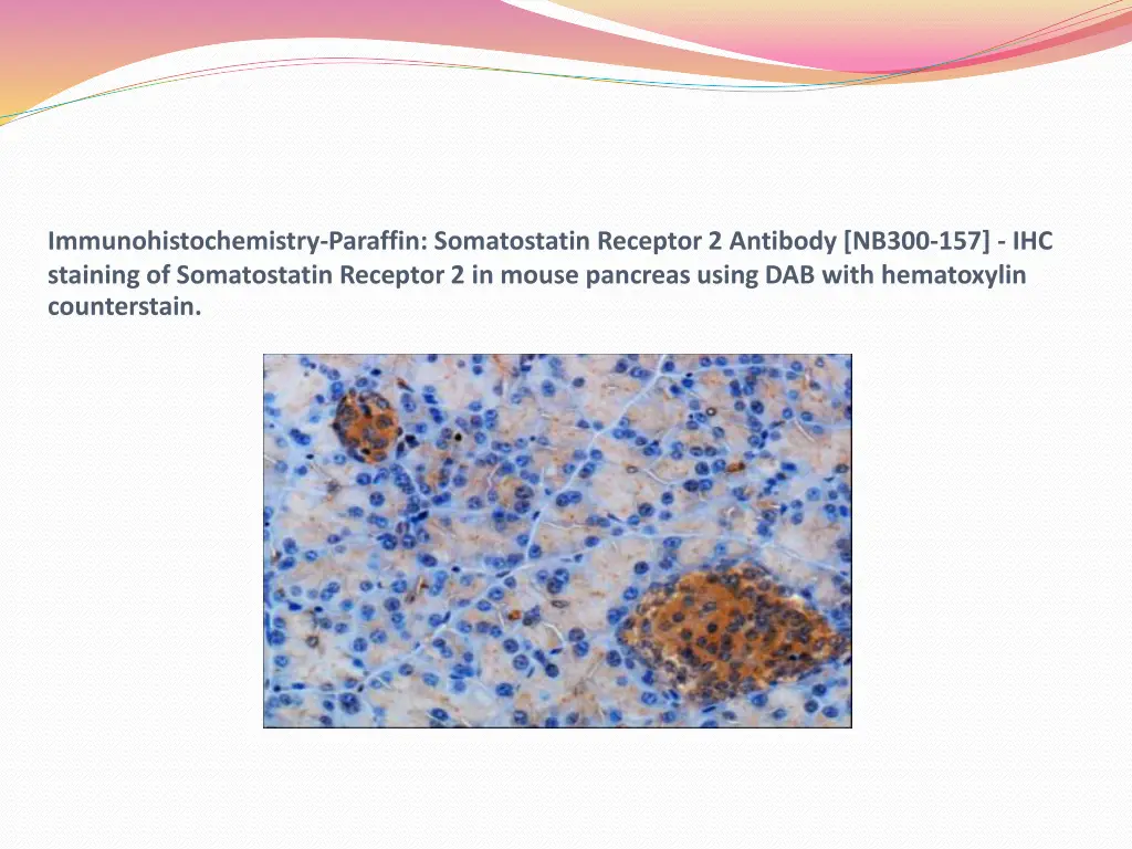 immunohistochemistry paraffin somatostatin