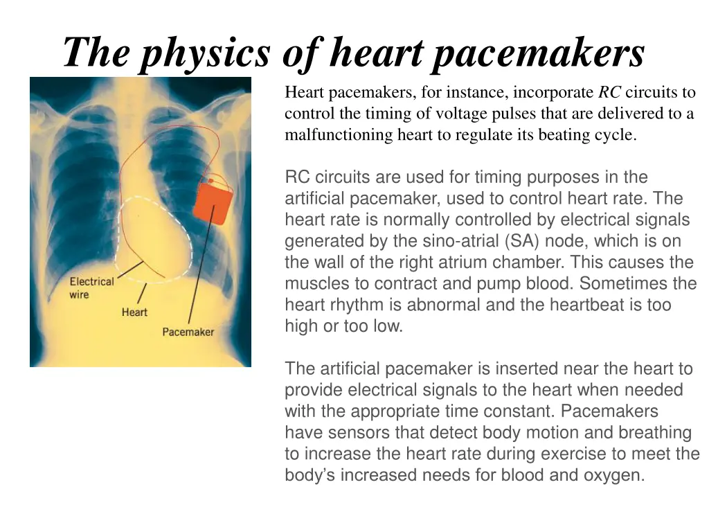 the physics of heart pacemakers heart pacemakers