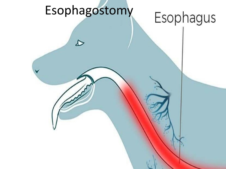 esophagostomy