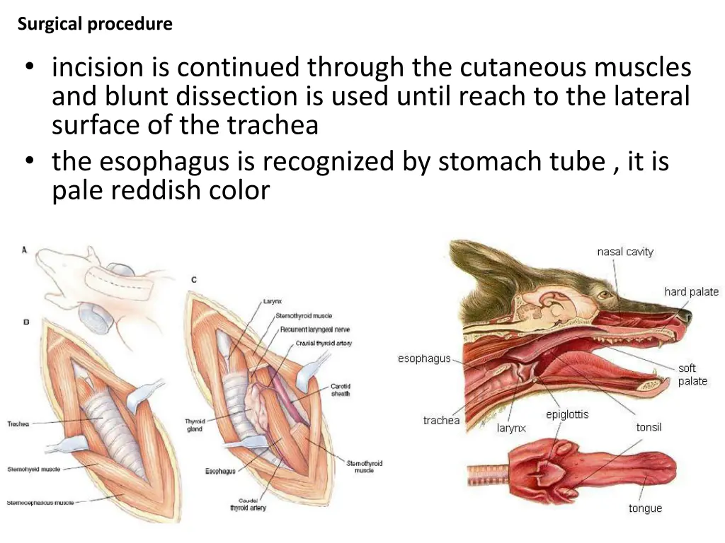 surgical procedure 1