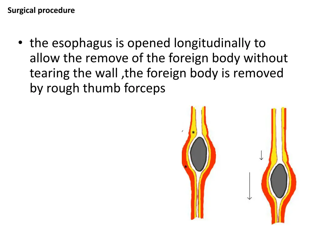 surgical procedure 2