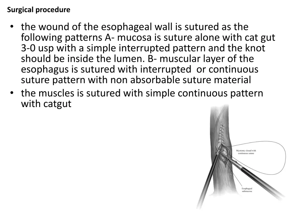 surgical procedure 3