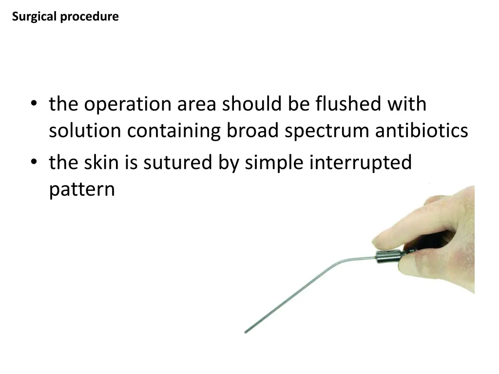 surgical procedure 4