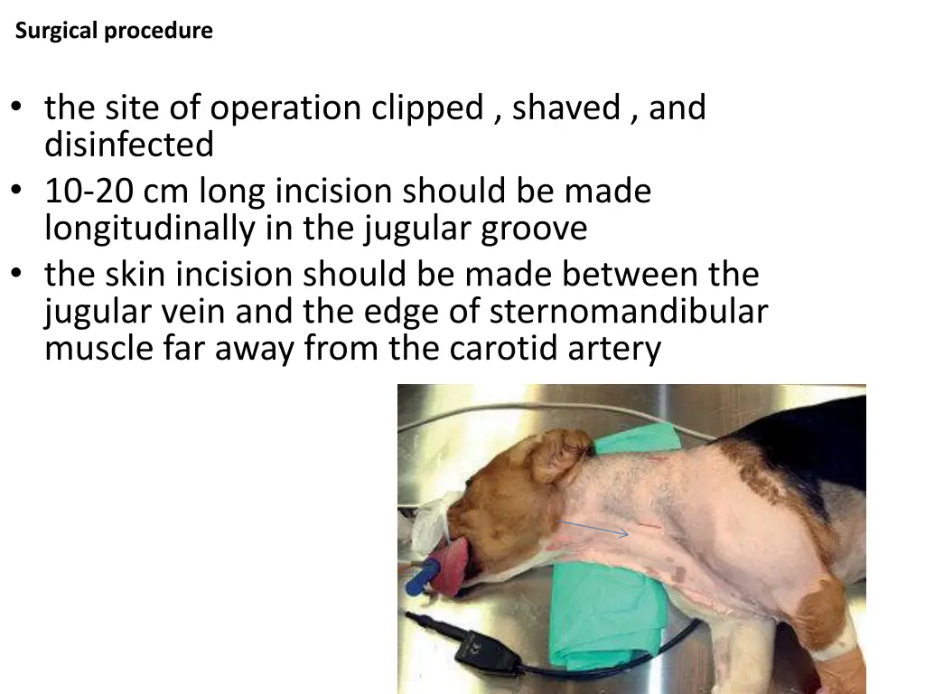 surgical procedure