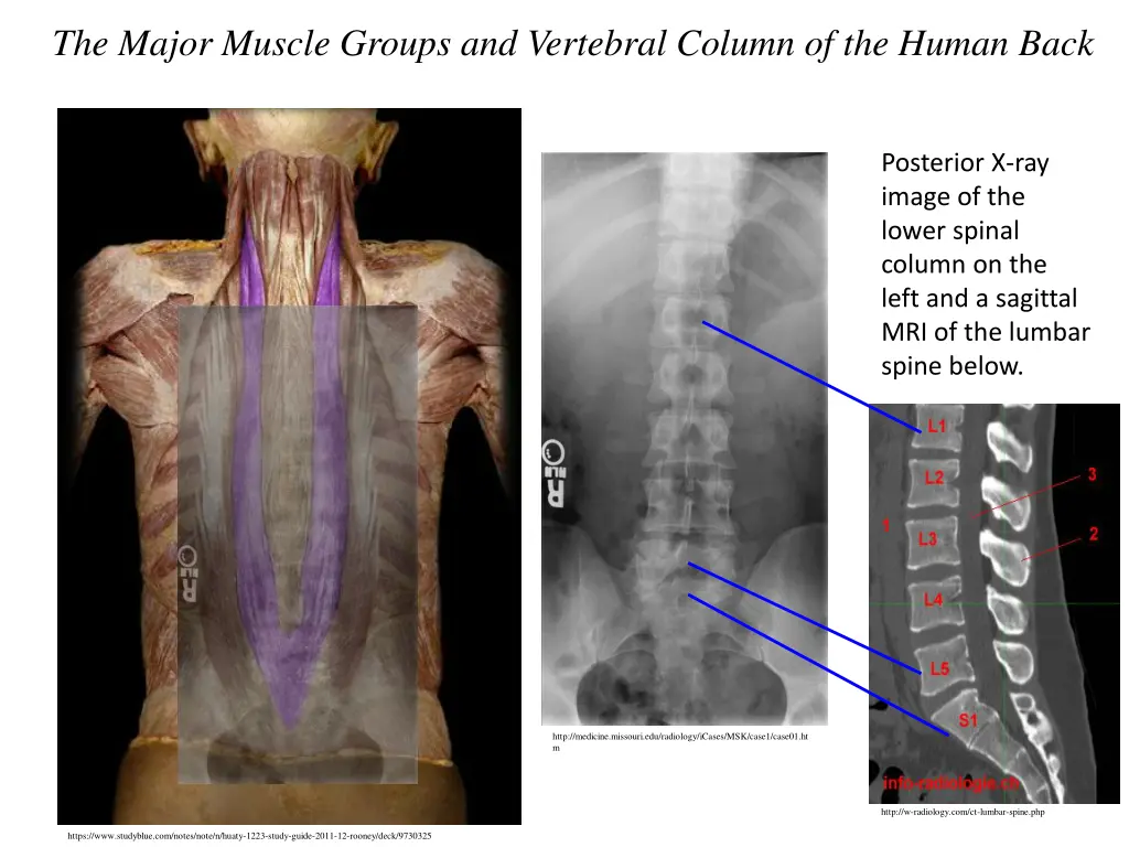 the major muscle groups and vertebral column