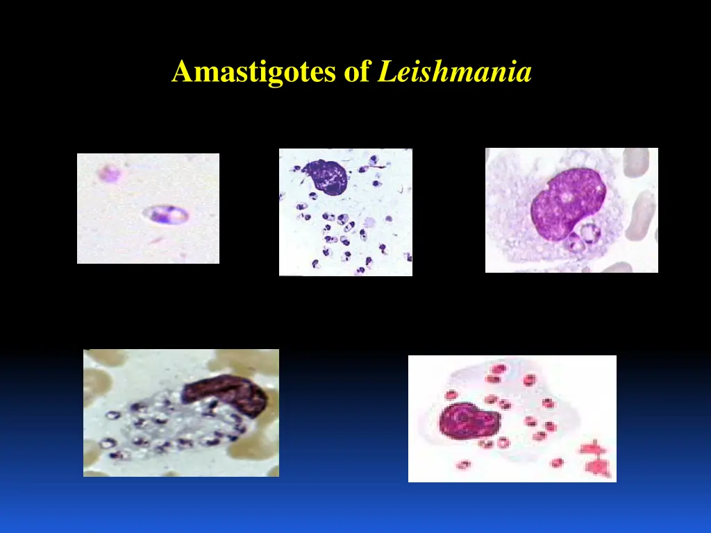 amastigotes of leishmania