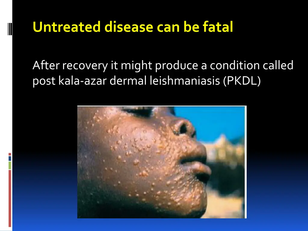 untreated disease can be fatal