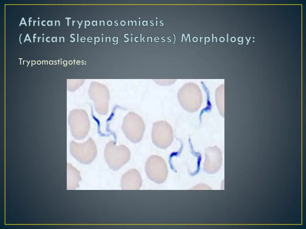 african trypanosomiasis african sleeping sickness