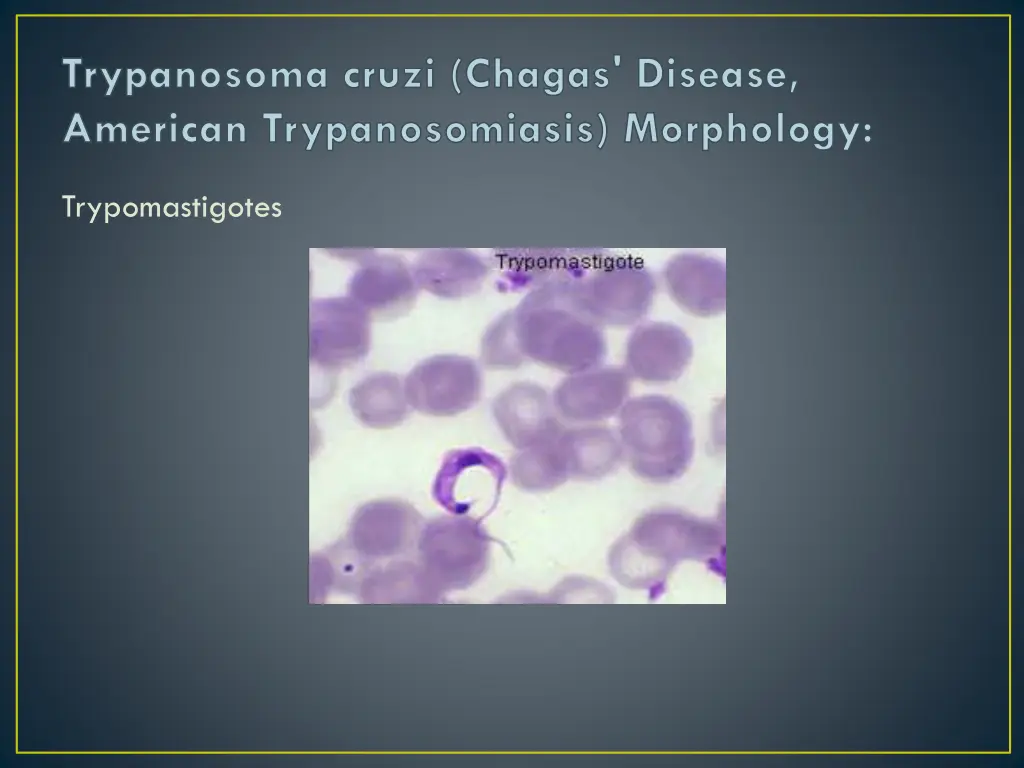 trypanosoma cruzi chagas disease american