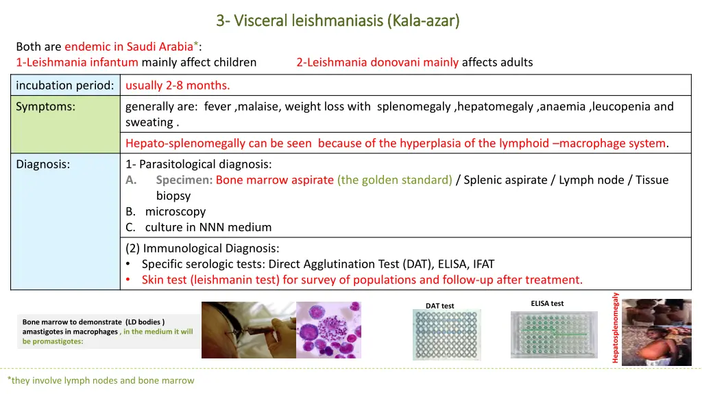 3 3 visceral leishmaniasis kala visceral