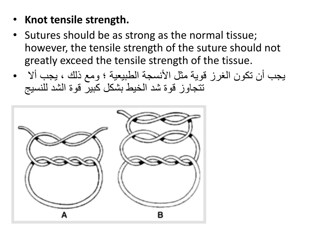 knot tensile strength sutures should be as strong