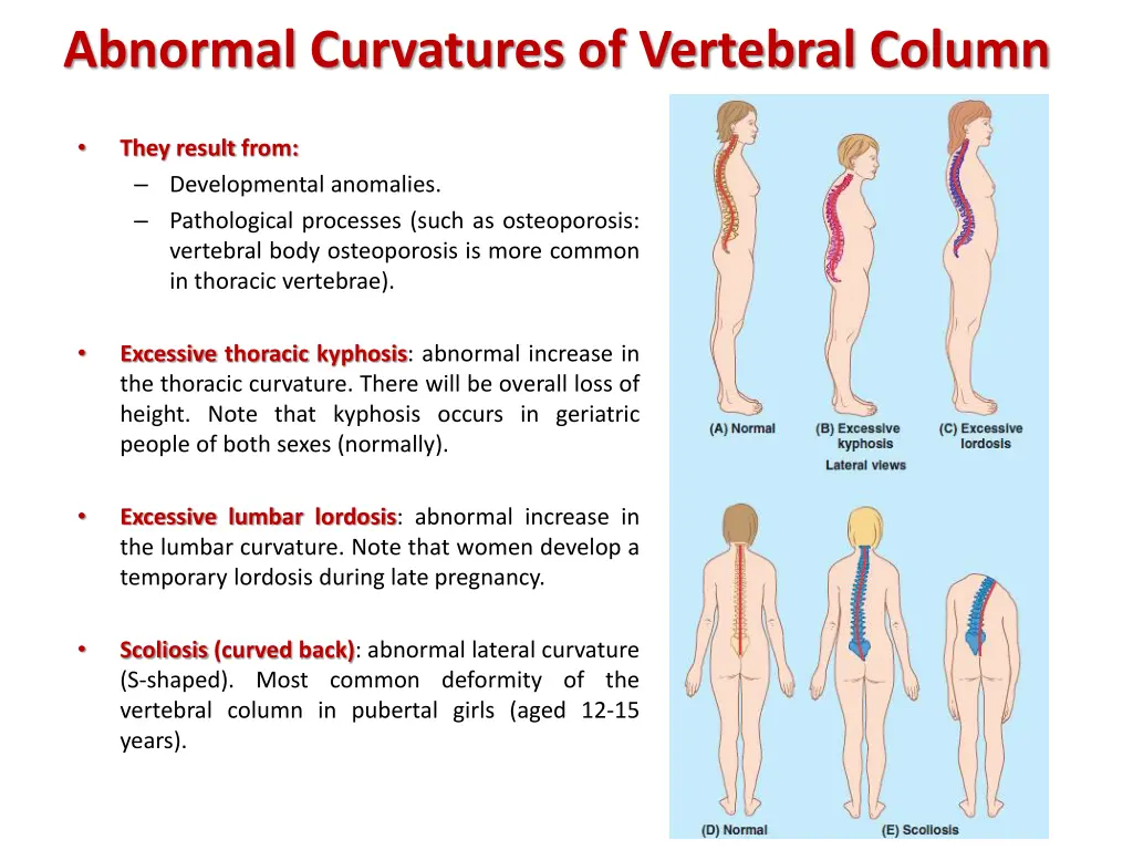 abnormal curvatures of vertebral column