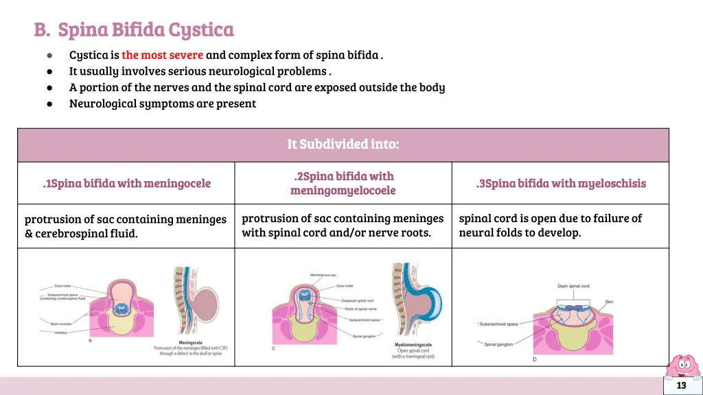 b spina bifida cystica b spina bifida cystica