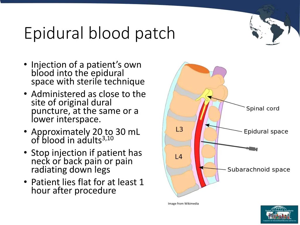 epidural blood patch 3