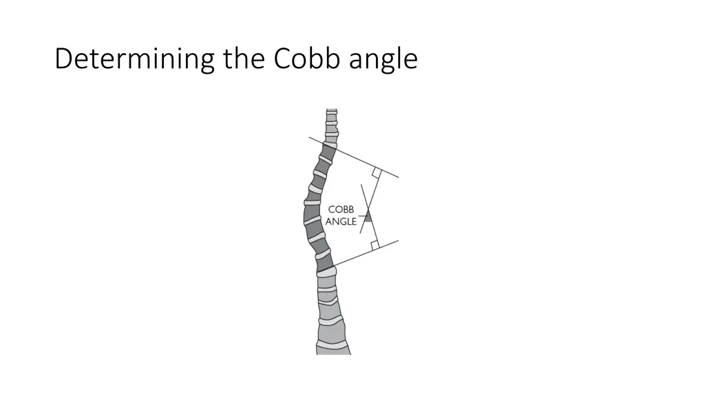 determining the cobb angle