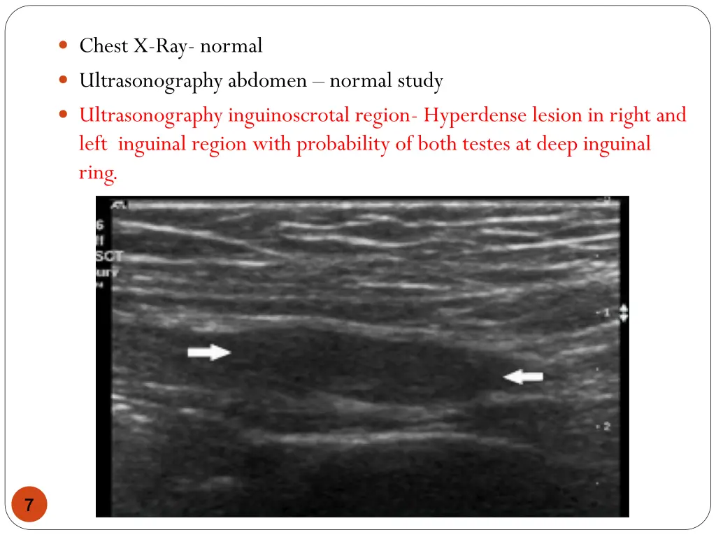 chest x ray normal ultrasonography abdomen normal