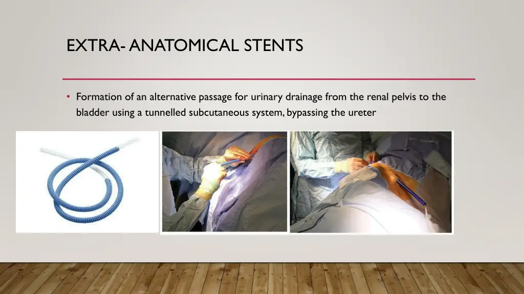 extra anatomical stents