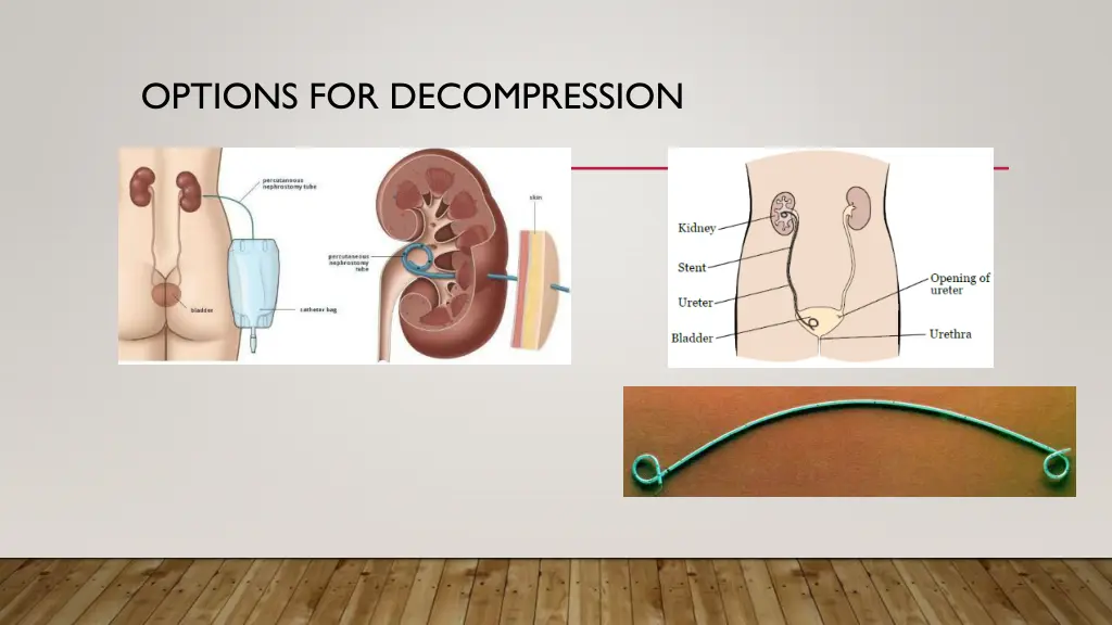 options for decompression