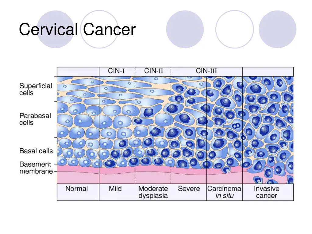 cervical cancer