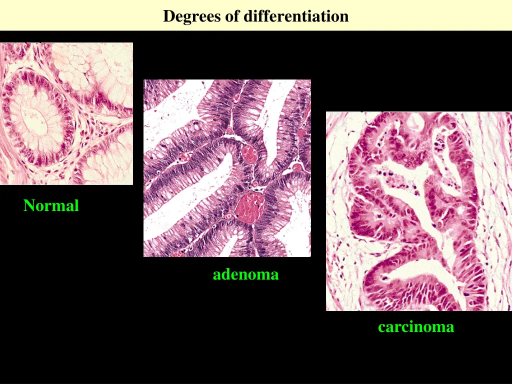 degrees of differentiation