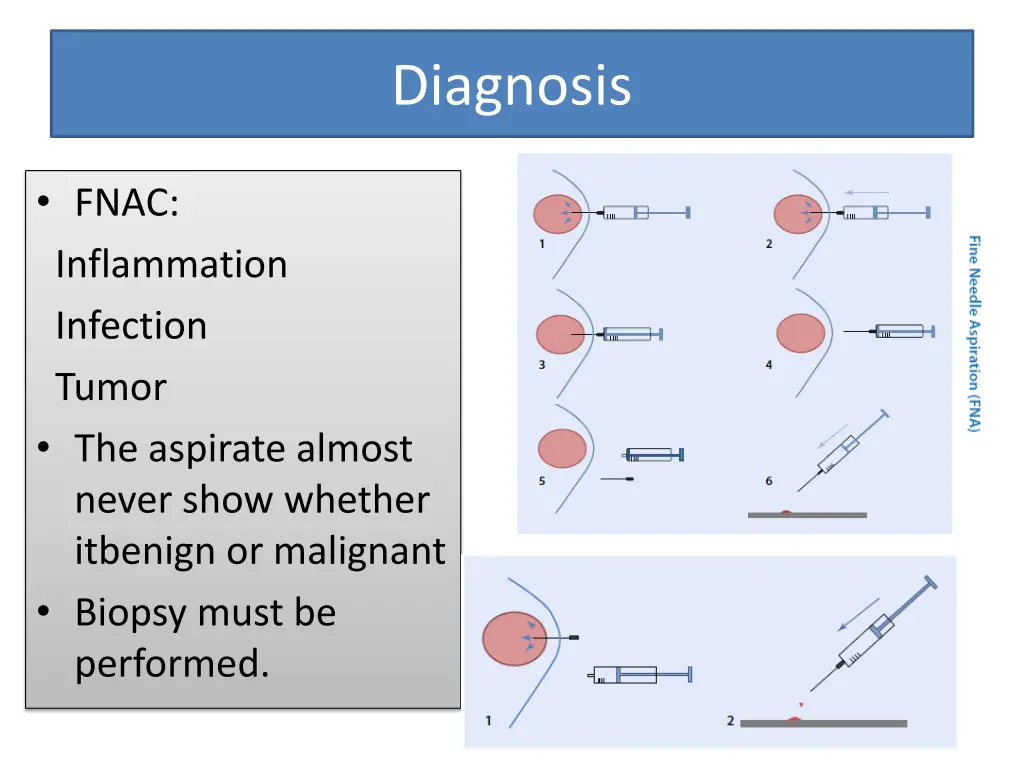 diagnosis