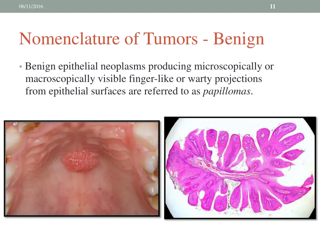 slide11