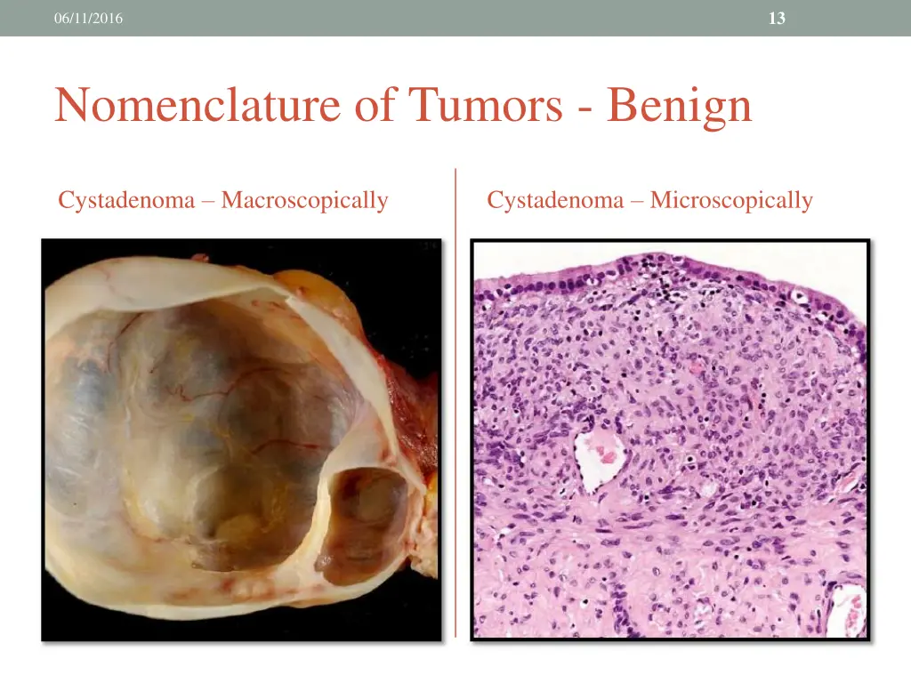 slide13