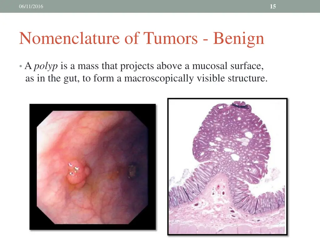 slide15