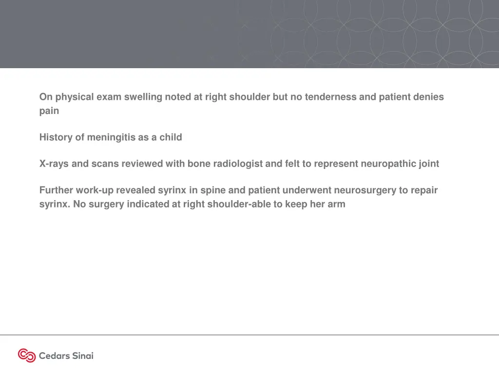 on physical exam swelling noted at right shoulder