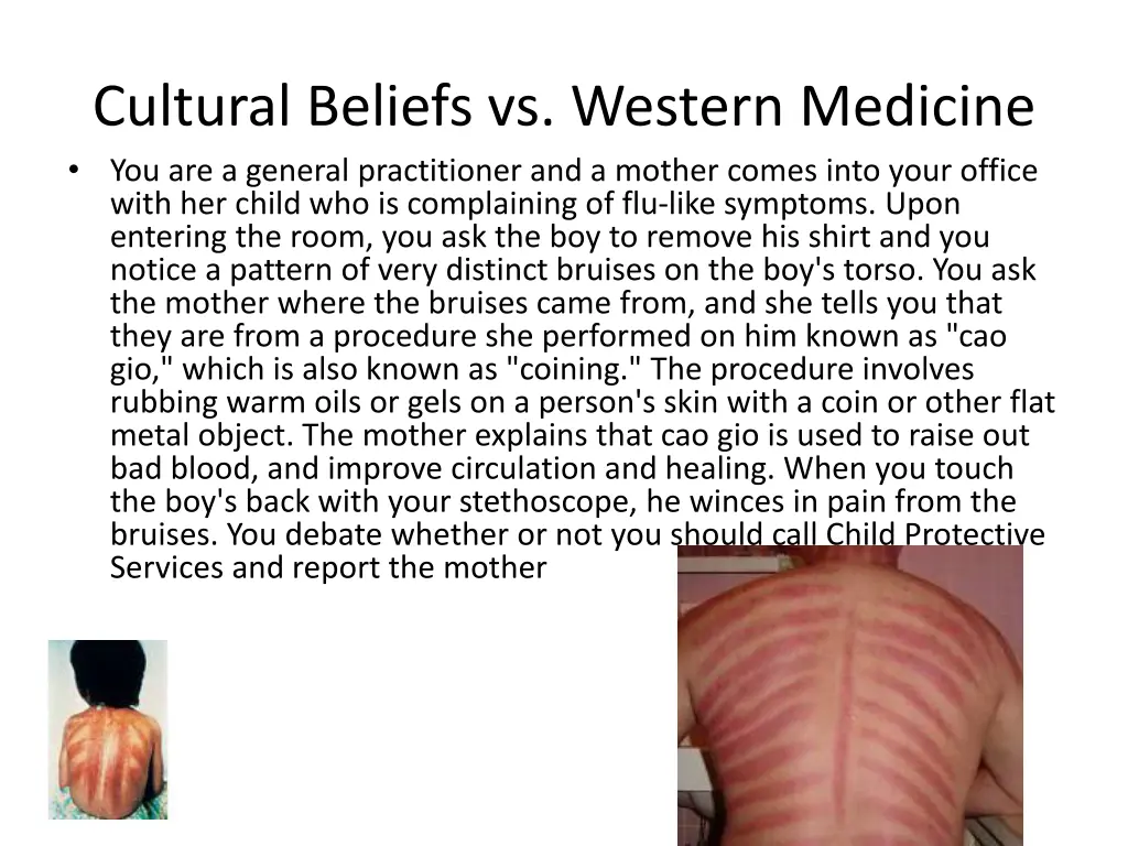 cultural beliefs vs western medicine