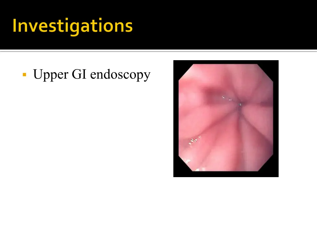 upper gi endoscopy 1