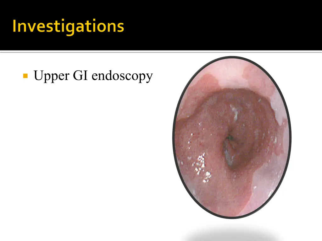 upper gi endoscopy 2