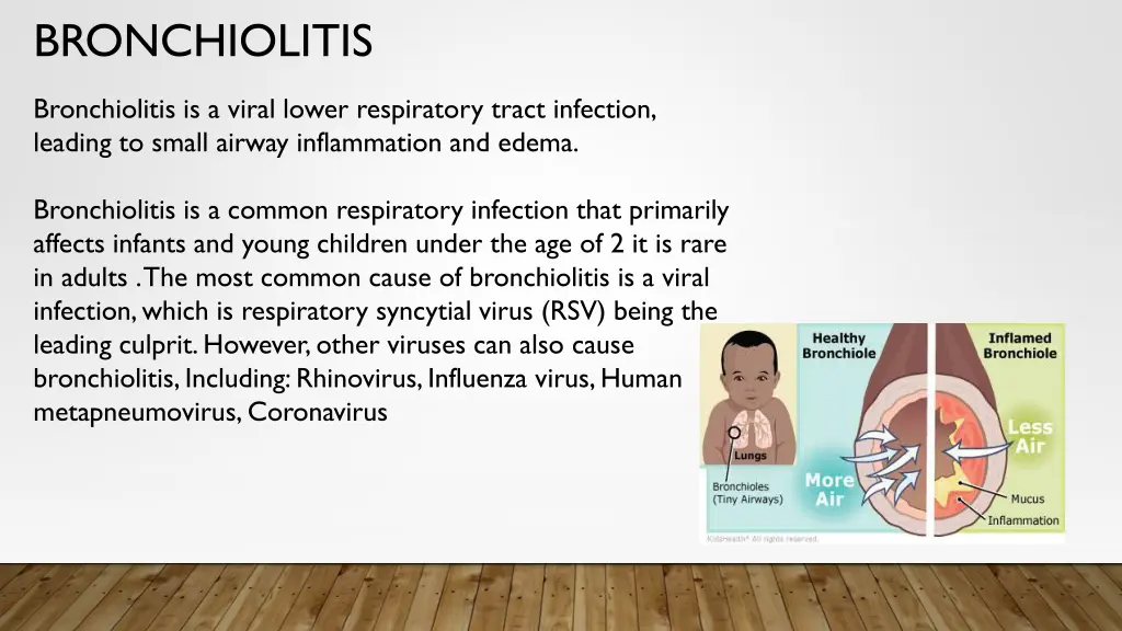 bronchiolitis 1