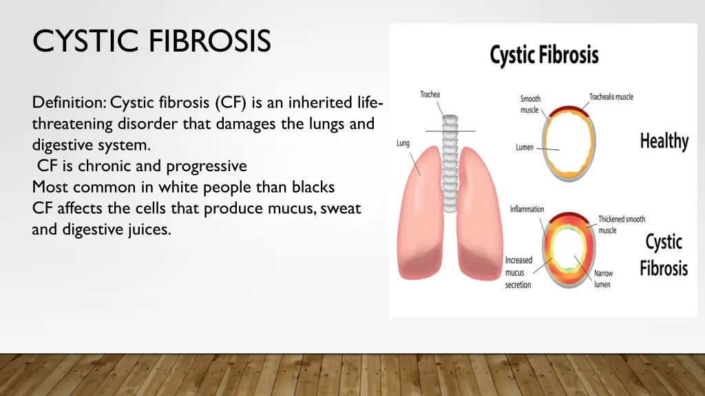 cystic fibrosis 1