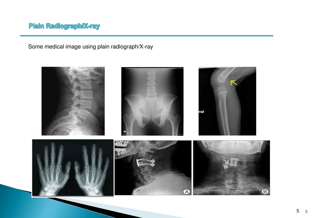 plain radiograph x ray 3