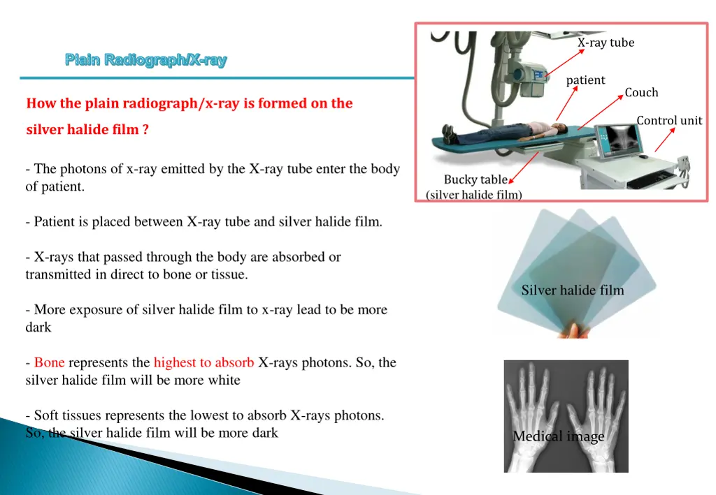 x ray tube