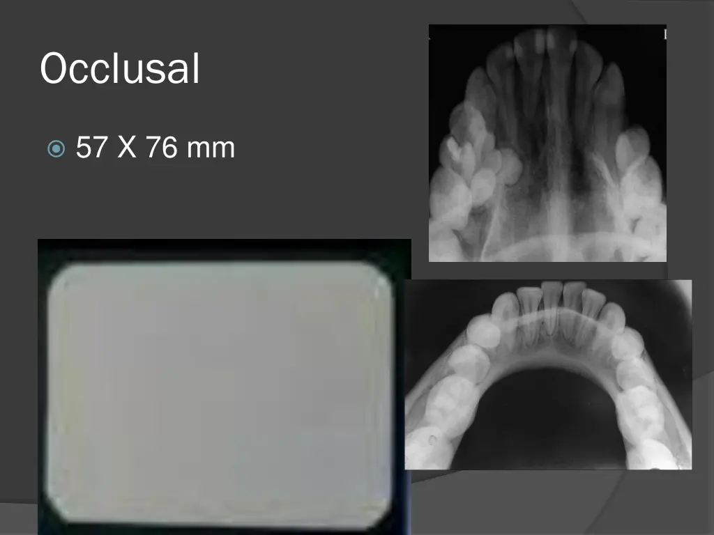 occlusal