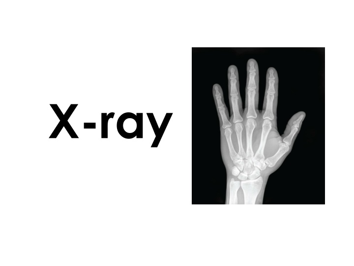 x ray