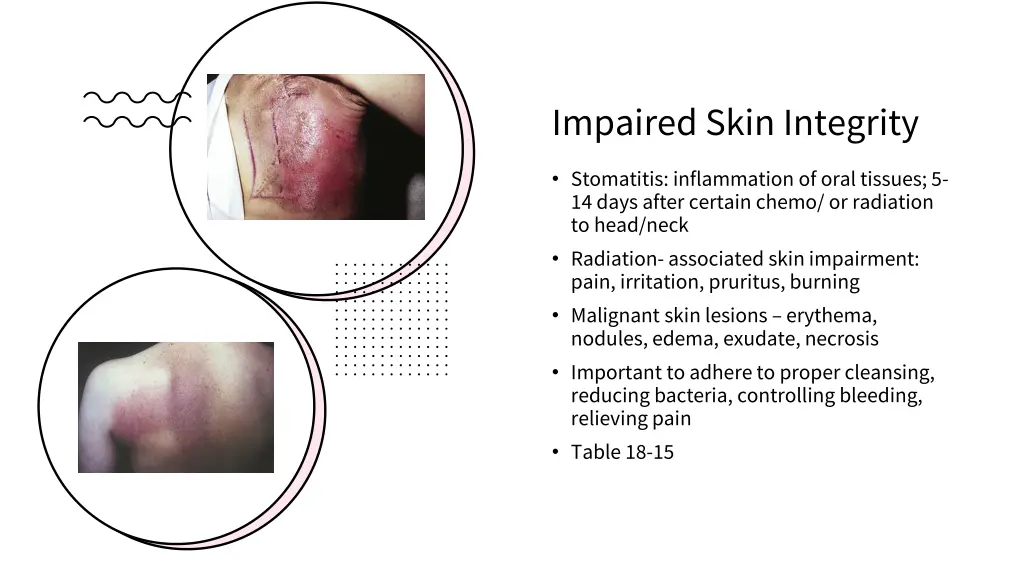 impaired skin integrity