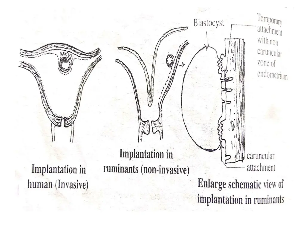 slide11