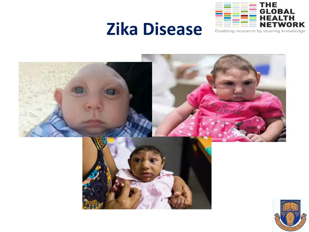 zika disease