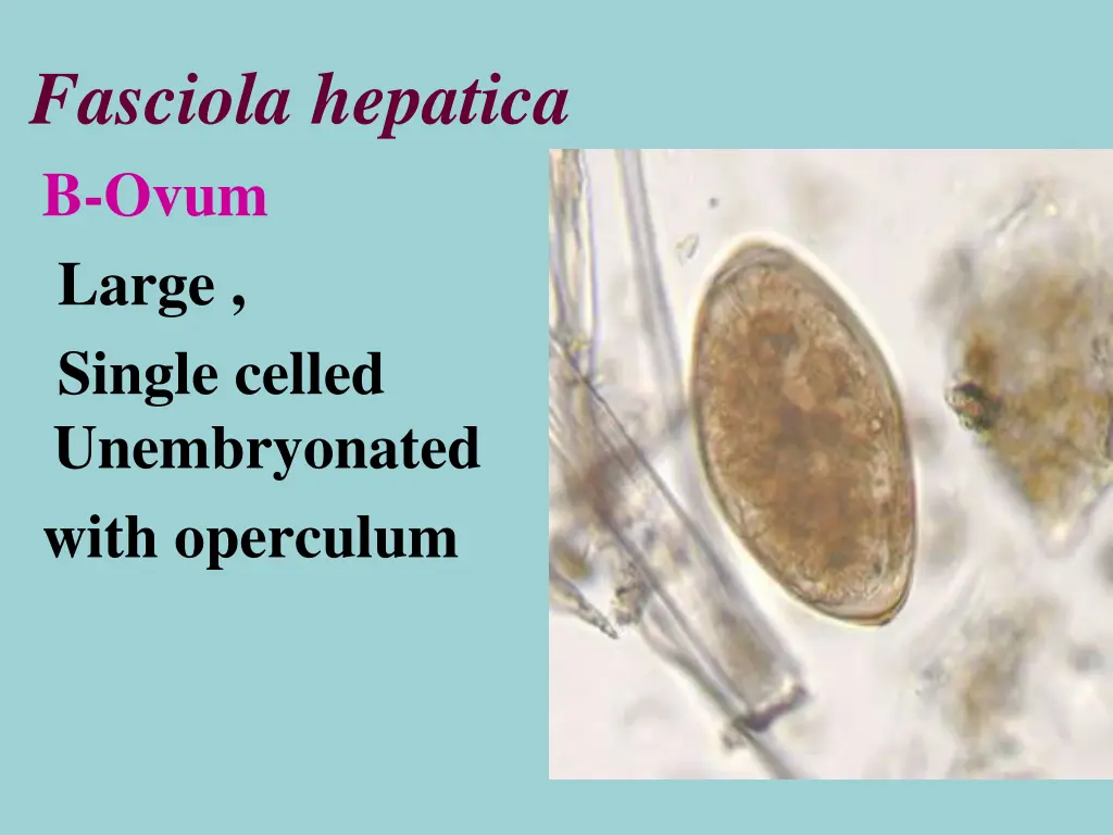 fasciola hepatica b ovum large single celled