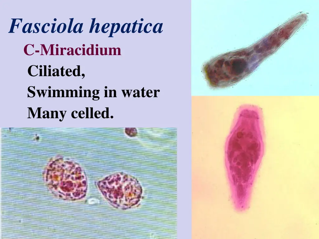 fasciola hepatica c miracidium ciliated swimming