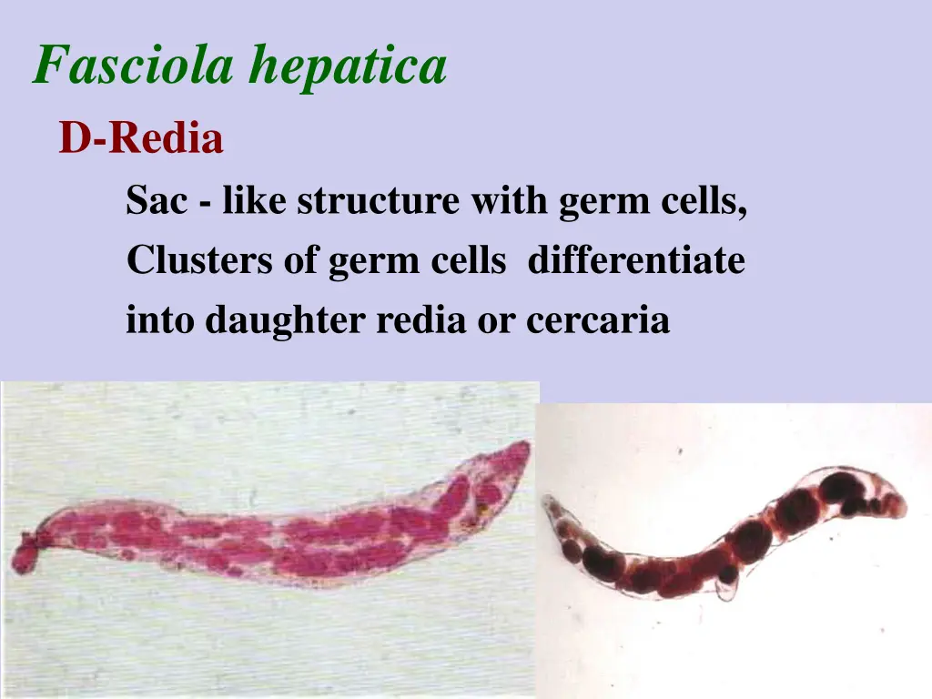 fasciola hepatica d redia sac like structure with