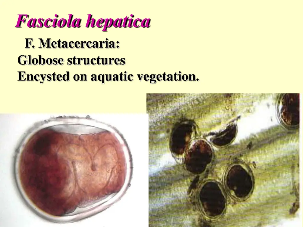 fasciola hepatica f metacercaria globose