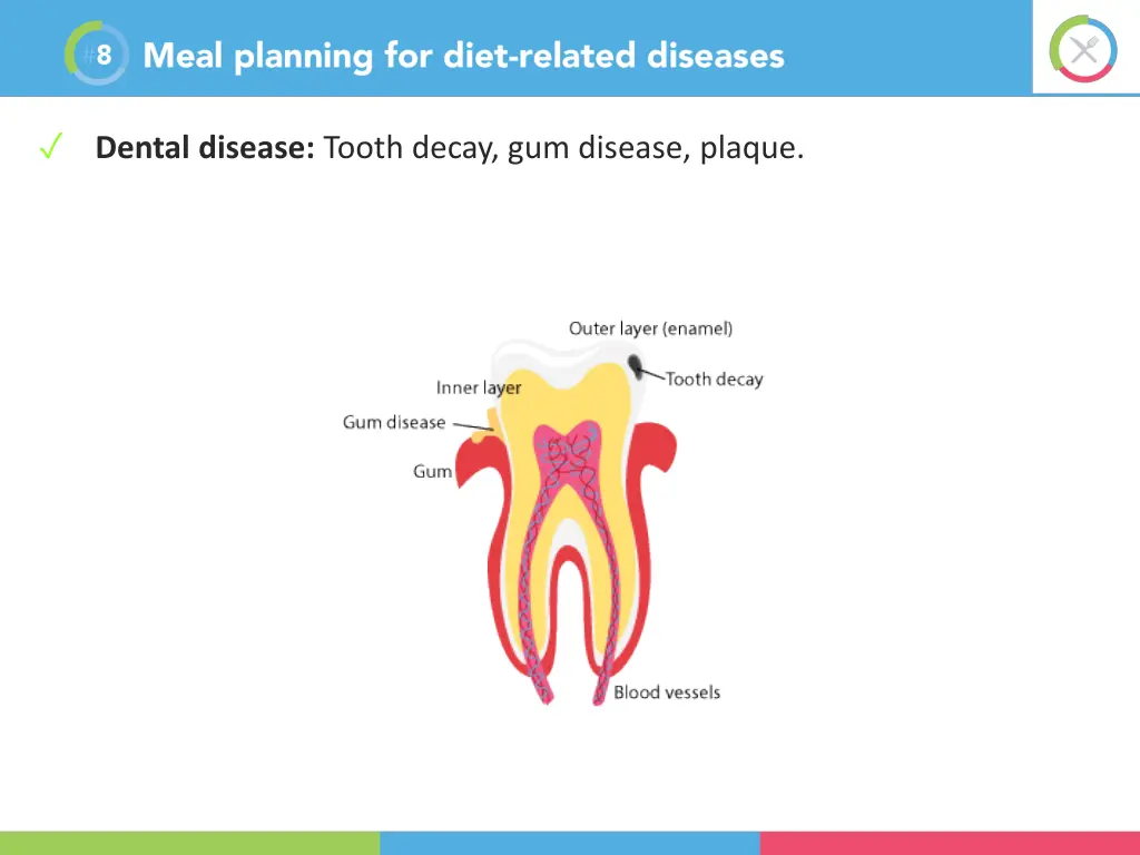 dental disease tooth decay gum disease plaque