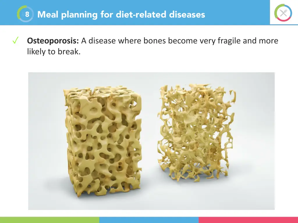 osteoporosis a disease where bones become very