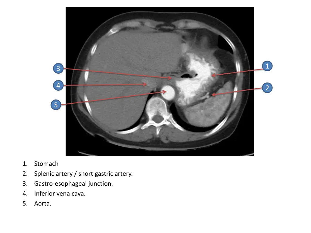 slide6