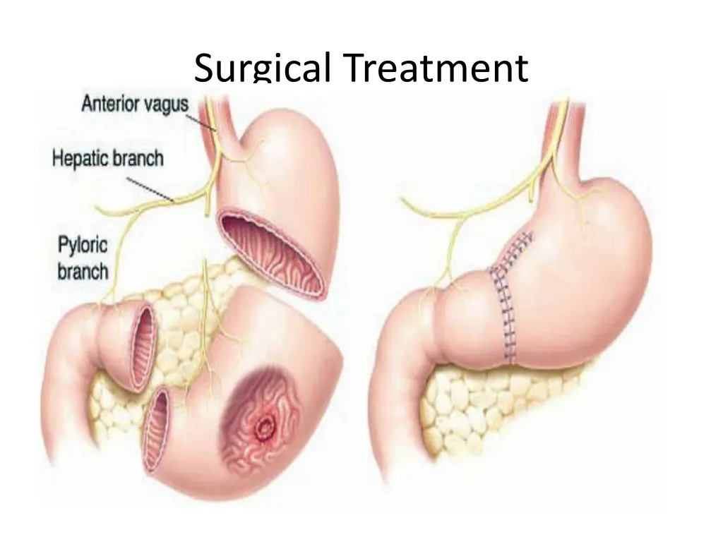 surgical treatment 1