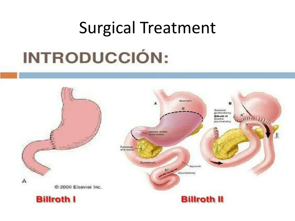 surgical treatment 2